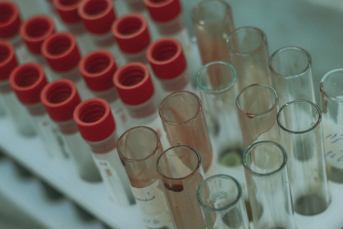 Laboratory beakers holding samples with red and white liquid