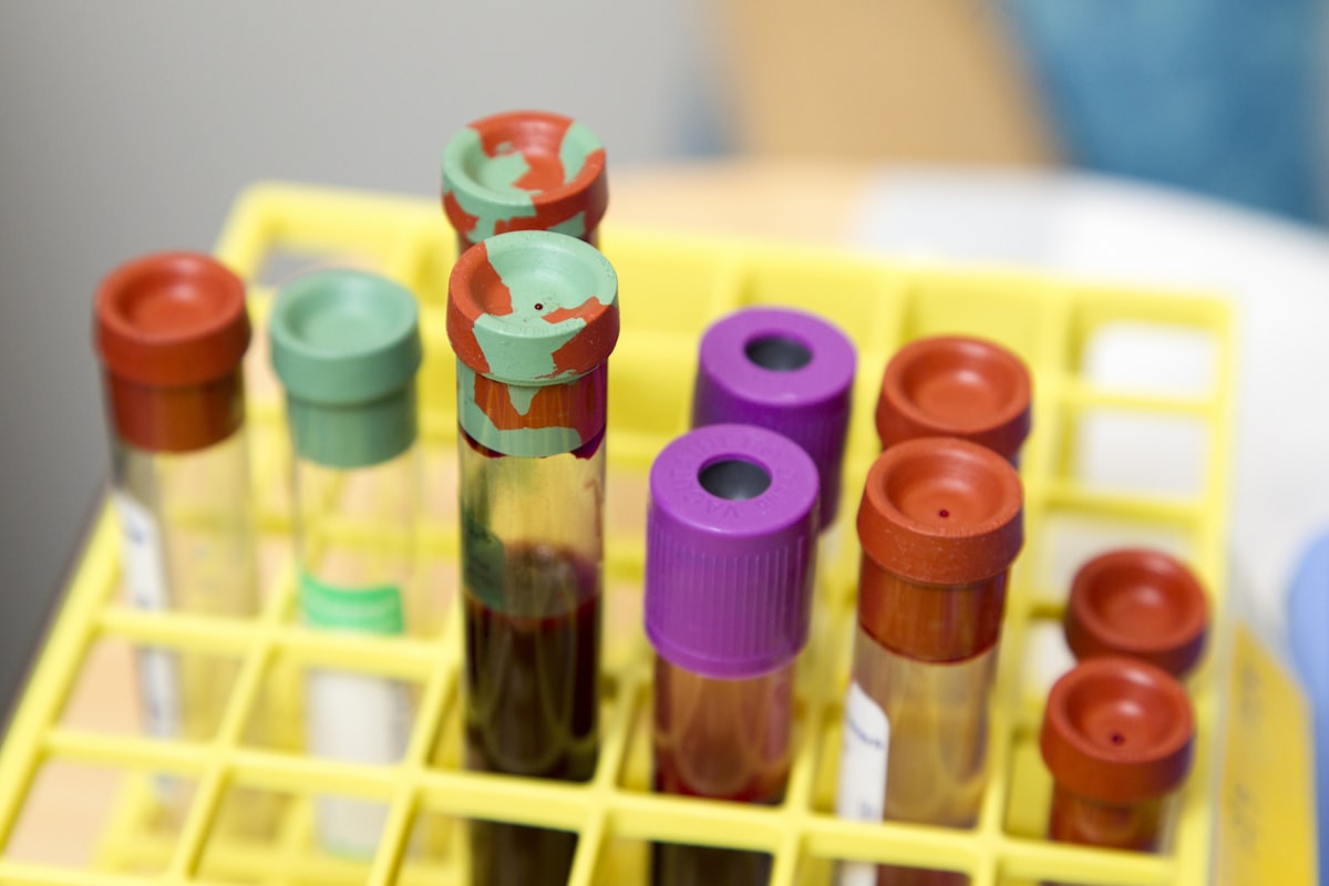 Clear glass laboratory test tubes in a rack
